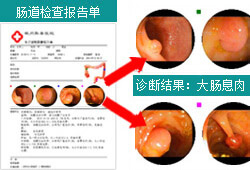 通泰疗法特色诊疗
