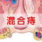 怎么进行混合痔的自测