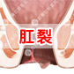 肛裂是怎么回事？