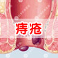 为什么会得痔疮
