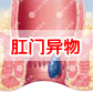 肛门有肿物拖出来是怎么回事