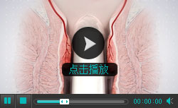 无刀除痔特色疗法