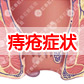 不可忽视女性痔疮的危害