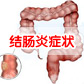 溃疡性结肠炎是什么？