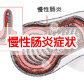 慢性肠炎急性发作的主要原因?