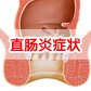 直肠炎的症状有哪些？
