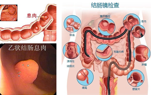 经常放屁是在“排毒”？或许“根源”在肠道！