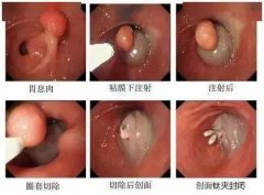 南宁胃肠科医院排名