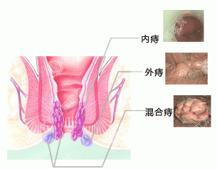 南宁肛肠医院