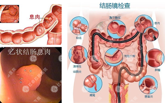 南宁哪家医院看胃病治疗比较好